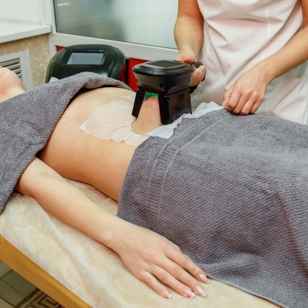 Cryolipolysis
